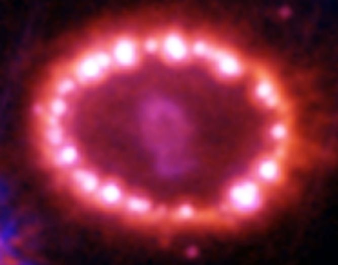 Les perles cosmiques de SN1987A